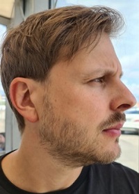 Tobias Winterbauer, rechte Seitenansicht des Gesichts