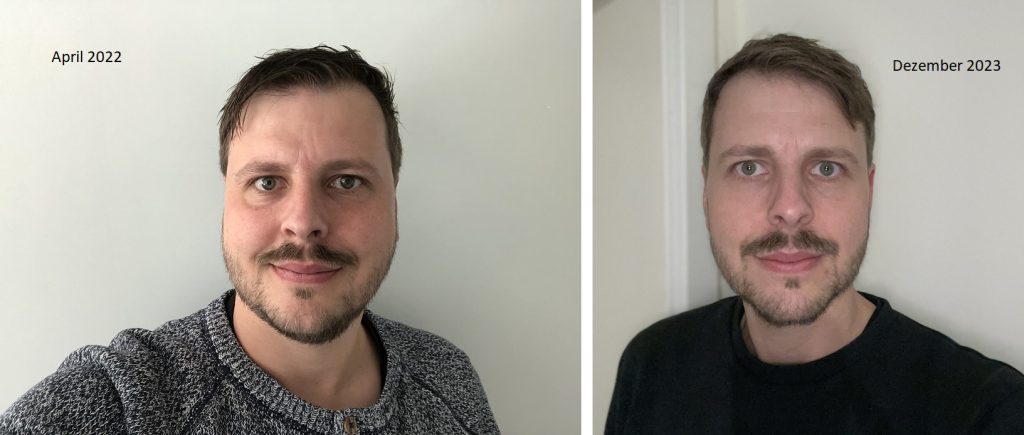 Zwei Selfies von Tobi nebeneinander. Links aus April 2022 mit 111 kg und rechts aus Dezember 2023 mit 81 kg. Die Gewichtsabnahme ist im Gesicht deutlich erkennbar. Das habe ich erreicht durch Motivation und Disziplin sowie den richtigen Auslöser und klare Ziele.
